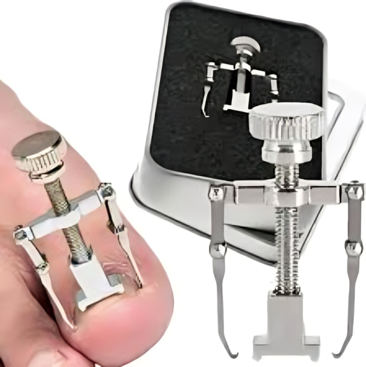 الحل النهائي لمشكل أظافر الرجلين – وداعاً للألم والتشقق والاصفرار 👣✨